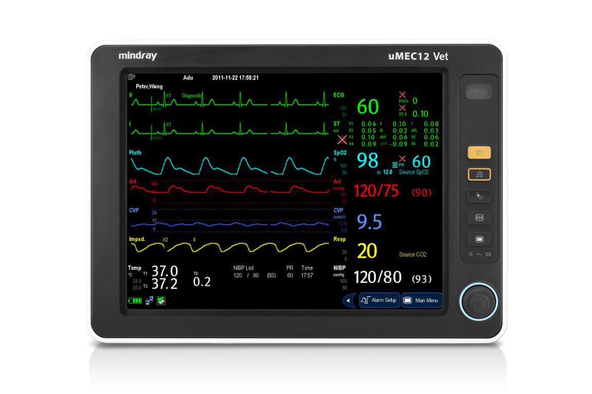 Mindray uMEC 12 "OP" Veterinär Patientenmonitor, 12,1" Touch, etCO2, EKG, SpO2, NIBP, Temp, Akku Mindray uMEC 12 "OP" Veterinär Patientenmonitor, 12,1" Touch, etCO2, EKG, SpO2, NIBP, Temp, Akku