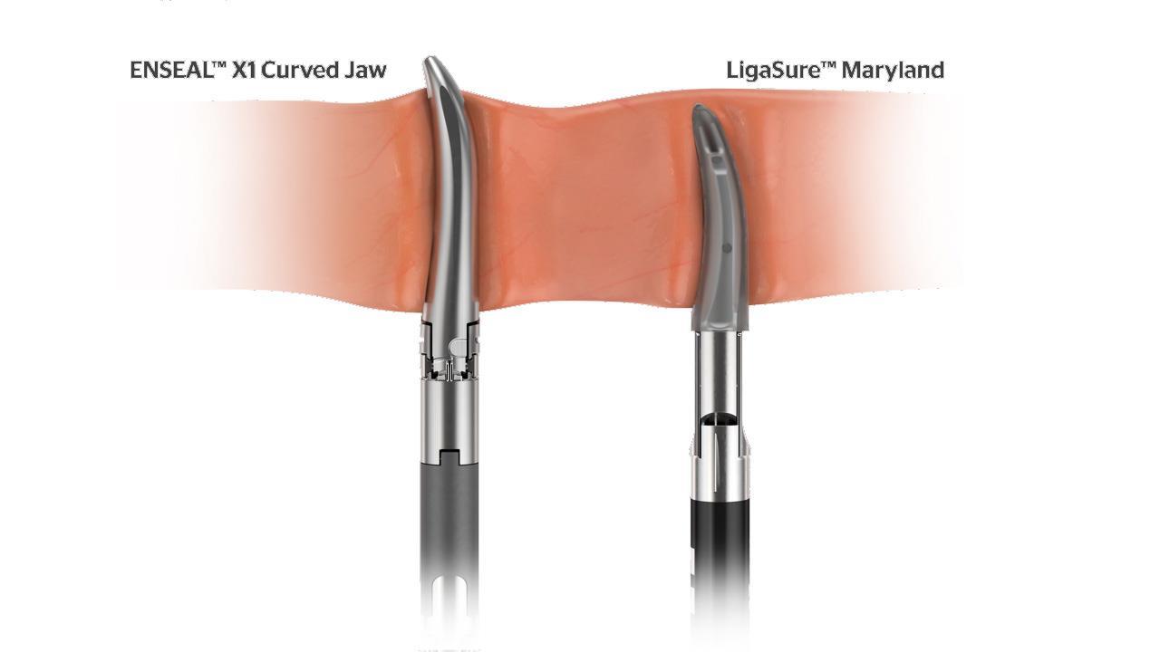 ENSEAL X1 Curved Jaw, 5mm Ø, 37cm Schaftlänge, 3 Stück ENSEAL X1 Curved Jaw, 5mm Ø, 37cm Schaftlänge, 3 Stück