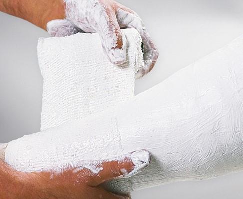 Cellona-Gipsbinden 6 cm x 2 m 10 Stück Cellona-Gipsbinden 6 cm x 2 m 10 Stück